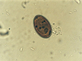 tachygonetria